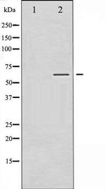 Phospho-SGK (Ser422) Antibody in Western Blot (WB)