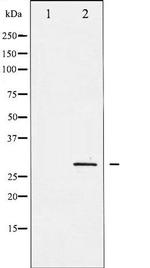 Phospho-SNAI1 (Ser246) Antibody in Western Blot (WB)