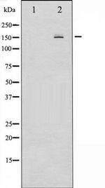 Phospho-EGFR (Ser1026) Antibody in Western Blot (WB)