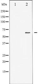 Phospho-Estrogen Receptor alpha (Ser167) Antibody in Western Blot (WB)