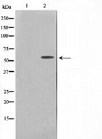 Phospho-Fyn (Tyr530) Antibody in Western Blot (WB)