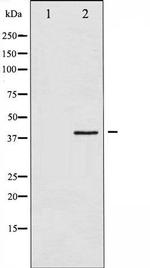 Phospho-hnRNP C1 + C2 (Ser260) Antibody in Western Blot (WB)