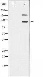 Phospho-IGF1R (Tyr1165, Tyr1166) Antibody in Western Blot (WB)