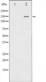 Phospho-PLC gamma 2 (Tyr753) Antibody in Western Blot (WB)