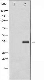 Phospho-CEBP beta (Thr188, Thr235) Antibody in Western Blot (WB)