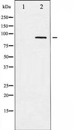 Phospho-ADD1 (Ser726) Antibody in Western Blot (WB)