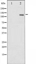 Phospho-SREBP1 (Ser439) Antibody in Western Blot (WB)