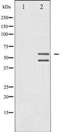 Phospho-JNK1/JNK2/JNK3 (Thr183, Tyr185) Antibody in Western Blot (WB)