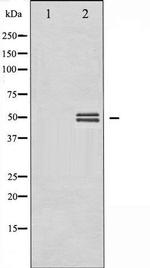 Phospho-GSK3 alpha/beta (Tyr279 , Tyr216) Antibody in Western Blot (WB)