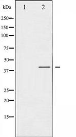 Phospho-CCR5 (Ser336) Antibody in Western Blot (WB)