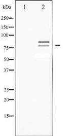 Phospho-Hormone-Sensitive Lipase (Ser554, Ser855) Antibody in Western Blot (WB)
