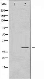 Phospho-BCL-XL (Ser62) Antibody in Western Blot (WB)