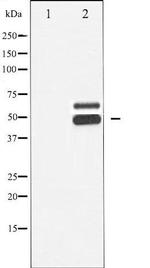 Phospho-CaMKII beta/gamma/delta (Thr287) Antibody in Western Blot (WB)