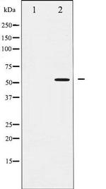 Phospho-SMAD2 (Ser467) Antibody in Western Blot (WB)