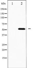 Phospho-p70 S6 Kinase beta (Ser423) Antibody in Western Blot (WB)