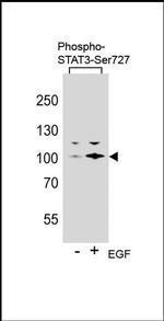 Phospho-STAT3 (Ser727) Antibody in Western Blot (WB)