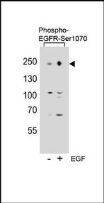 Phospho-EGFR (Ser1070) Antibody in Western Blot (WB)