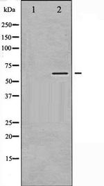 Phospho-CaMKII (Thr305) Antibody in Western Blot (WB)