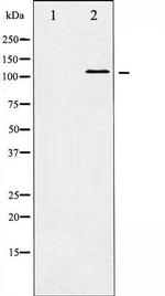 Phospho-HDAC5 (Ser498) Antibody in Western Blot (WB)