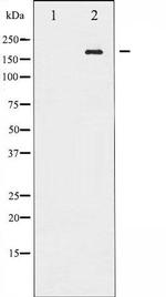 Phospho-ALK (Tyr1507) Antibody in Western Blot (WB)