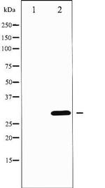 Phospho-DARPP-32 (Thr75) Antibody in Western Blot (WB)