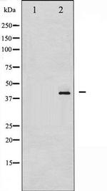 Phospho-HDAC8 (Ser39) Antibody in Western Blot (WB)