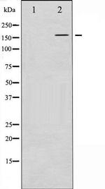 Phospho-FANCD2 (Ser222) Antibody in Western Blot (WB)