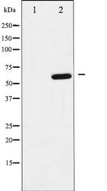Phospho-p62 Dok (Tyr398) Antibody in Western Blot (WB)