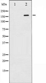 Phospho-ASK1 / MAP3K5 (Ser966) Antibody in Western Blot (WB)