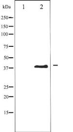 Phospho-Aurora B (Thr232) Antibody in Western Blot (WB)