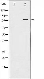Phospho-SirT1 (Ser47) Antibody in Western Blot (WB)