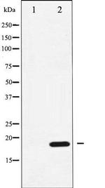 Phospho-CPI-17 (Thr38) Antibody in Western Blot (WB)