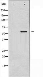 Phospho-CaMK4 (Thr200) Antibody in Western Blot (WB)