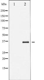 Phospho-I kappa-B-beta (Thr19) Antibody in Western Blot (WB)