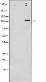 Phospho-PKD1/2/3/PKC mu (Ser738, Ser742) Antibody in Western Blot (WB)