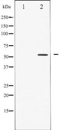 Phospho-Caspase 8 (Ser347) Antibody in Western Blot (WB)