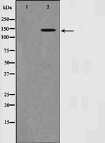 Phospho-SMC1 (Ser957) Antibody in Western Blot (WB)