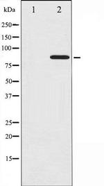 Phospho-Cortactin (Tyr466) Antibody in Western Blot (WB)