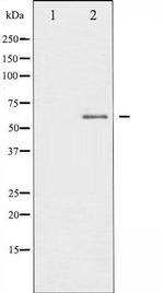 Phospho-IL10R / IL-10 Receptor alpha (Tyr496) Antibody in Western Blot (WB)