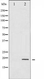 Phospho-4E-BP1 (Thr36) Antibody in Western Blot (WB)