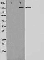 Phospho-Acetyl-CoA Carboxylase (Ser80) Antibody in Western Blot (WB)