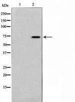 Phospho-FOXO1 (Ser256) Antibody in Western Blot (WB)