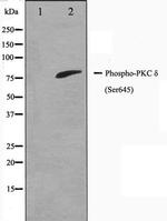 Phospho-PKC delta (Ser645) Antibody in Western Blot (WB)