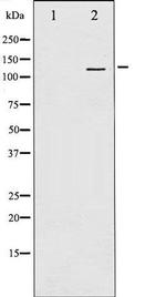 Phospho-NMDA Receptor 1 (Ser897) Antibody in Western Blot (WB)