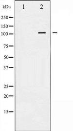 Phospho-Hormone-sensitive Lipase (Ser552) Antibody in Western Blot (WB)