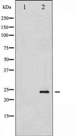 Phospho-Caveolin-1 (Tyr14) Antibody in Western Blot (WB)