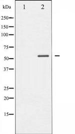 Phospho-MEF2A (Thr319) Antibody in Western Blot (WB)