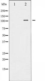 Phospho-NFkB p52 (Ser869) Antibody in Western Blot (WB)