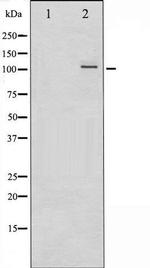 Phospho-NFkB p52 (Ser865) Antibody in Western Blot (WB)