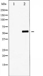 Phospho-FOXO4 (Thr451) Antibody in Western Blot (WB)